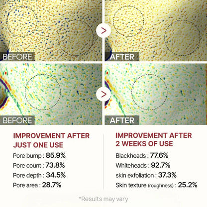 Final Days: 40% OFF🔥 Gentle Exfoliator Glow Rice Ampoule-Suitable for All Skin Types