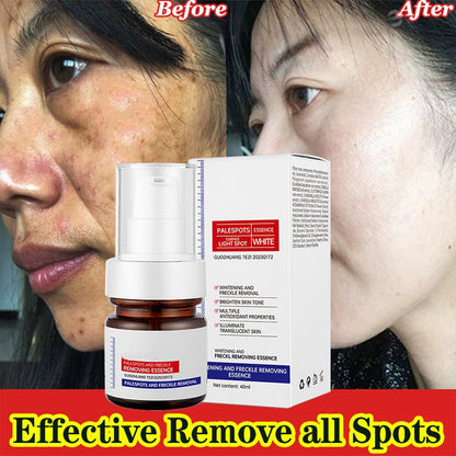 ⚡5-second brightening！Vitamin C Whitening Freckles ESSENCE