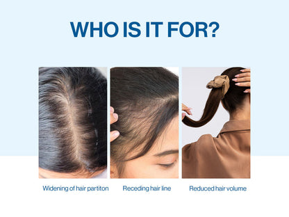 🔥Hot Sale 50% Off🎁Advanced Hair Growth Serum Roll On