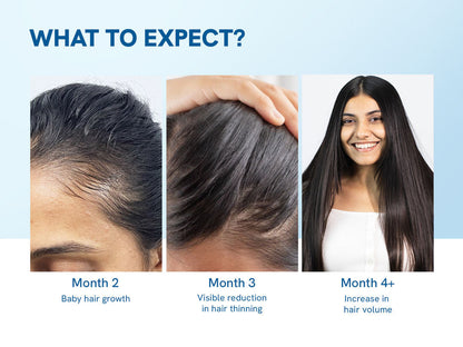 🔥Hot Sale 50% Off🎁Advanced Hair Growth Serum Roll On