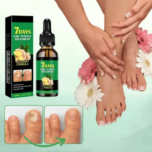 🔥Hot Sale 50% Off🎁7 DAYS NAIL FUNGUS TREATMENT - Protege y elimina el hongo de tus Uñas